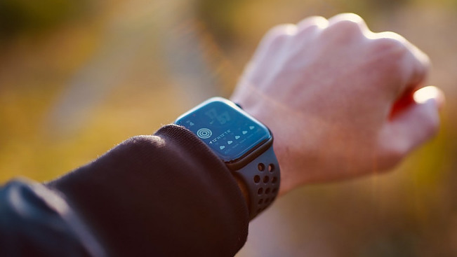 Picture of a mans arm showing a smart watch